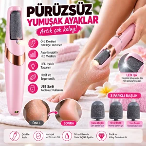 TOPUK TÖRPÜSÜ